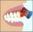 Natural Teeth Whitening By Berry Nature